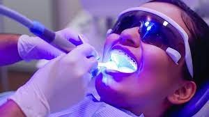 Laser Teeth Whitening