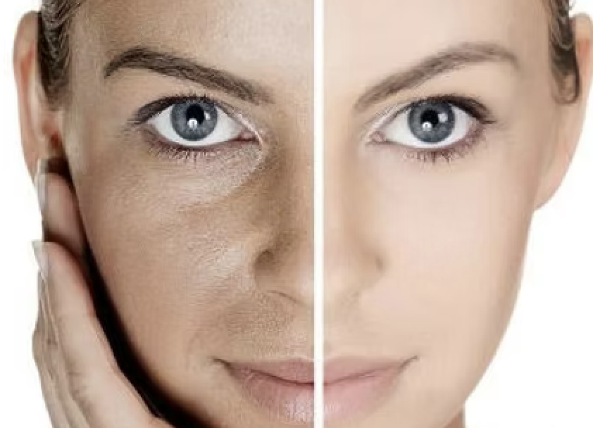 Skin Care