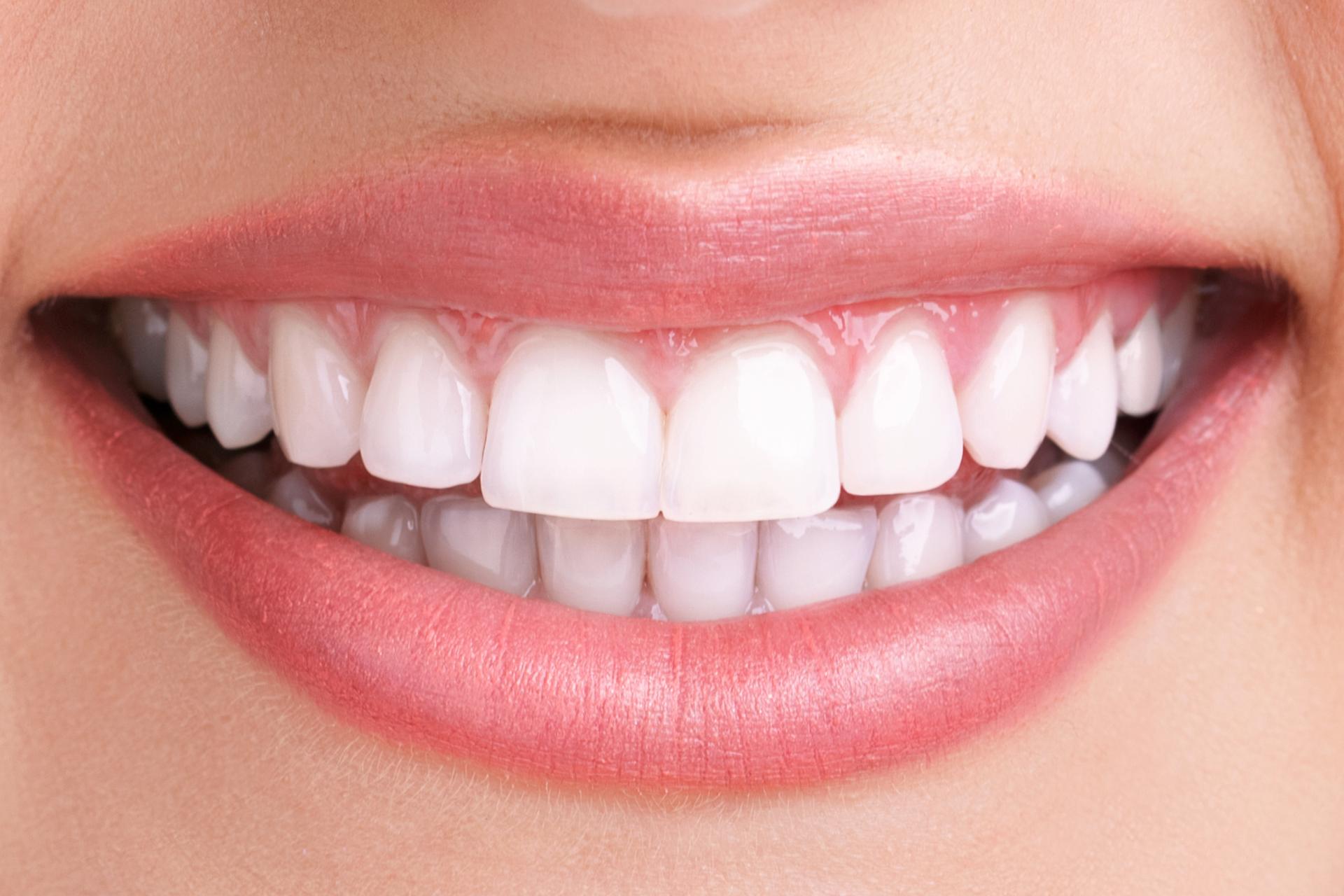 Dental Care
